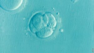 Pročitajte više o članku Može li embrij ispasti